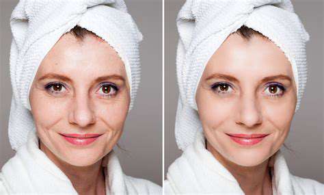 AddressingSpecificSkinConcernswithNutrition